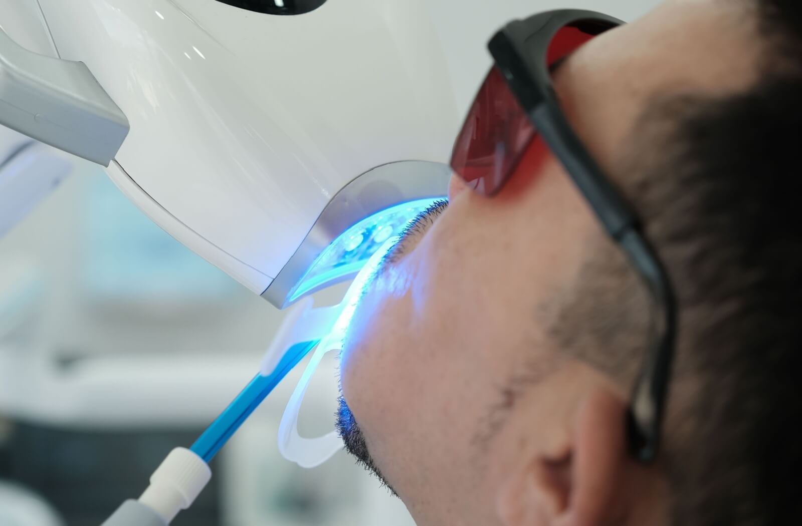 Patient undergoing in-office teeth whitening procedure using advanced equipment for a brighter and more radiant smile