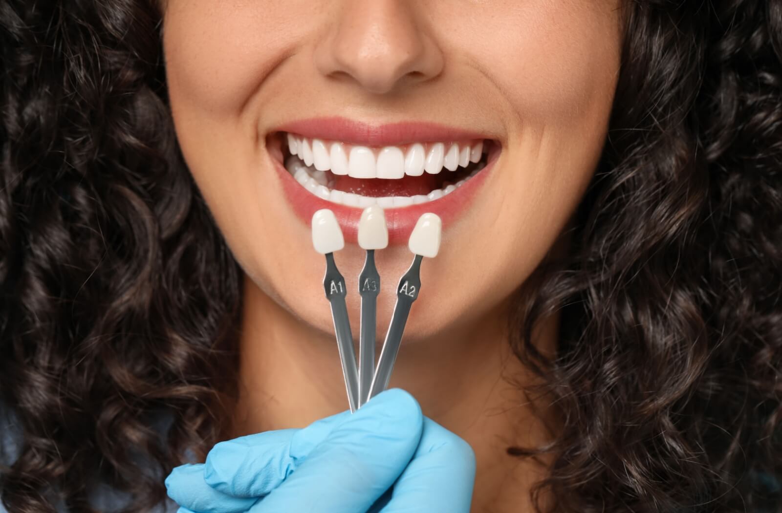 A dentist checking a young person's teeth colour with veneers close-up.